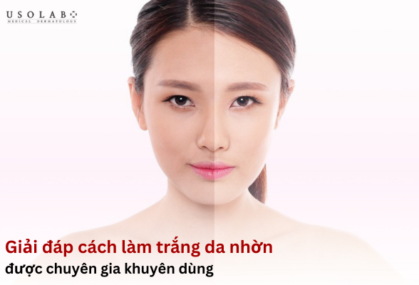 cách làm trắng da nhờn
