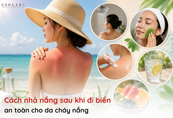 cách nhả nắng sau khi đi biển