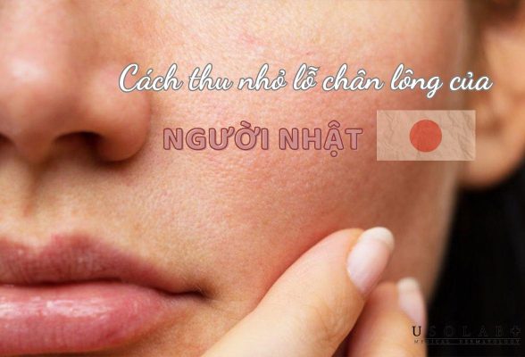 cách thu nhỏ lỗ chân lông của người nhật