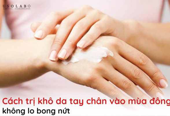 cách trị khô da tay chân vào mùa đông