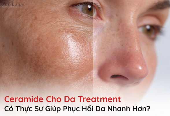 ceramide cho da treatment