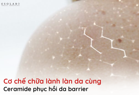 ceramide phục hồi da
