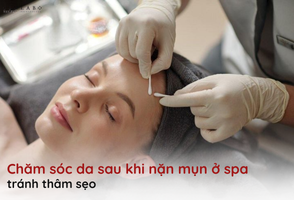 chăm sóc da sau khi nặn mụn ở spa