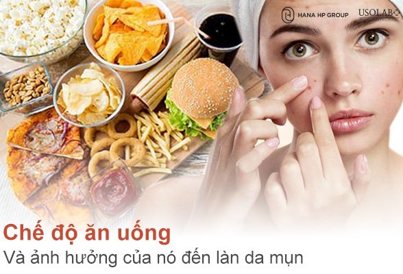 Chế độ ăn uống và ảnh hưởng của nó đến làn da mụn: Ăn gì để da khỏe, hạn chế mụn?