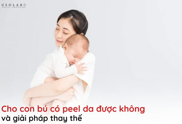 cho con bú có peel da được không