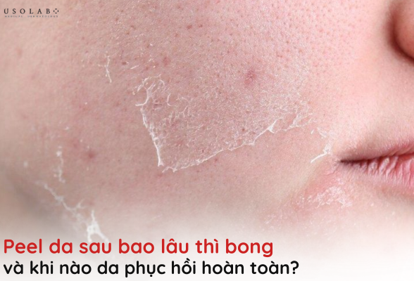 cho-con-bu-co-peel-da-duoc-khong (8)