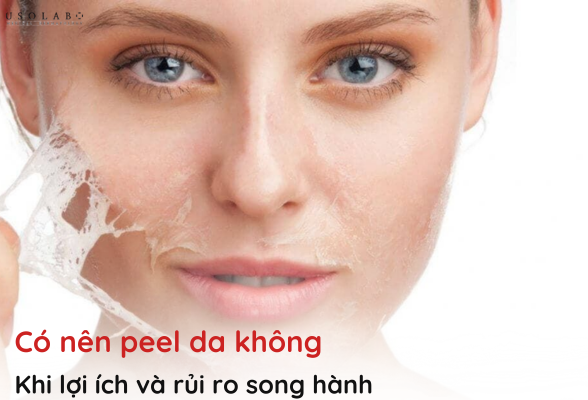 có nên peel da không
