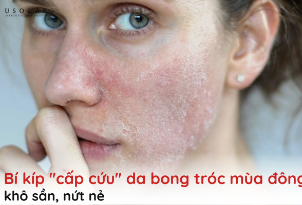 da bong tróc mùa đông