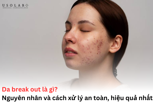 da break out là gì