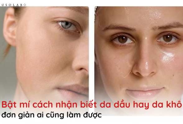 cách nhận biết da dầu hay da khô