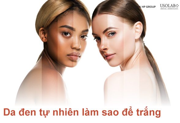 Da đen tự nhiên làm sao để trắng cách chăm sóc da đúng cách