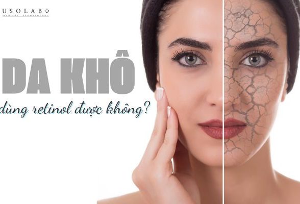 da khô có dùng được retinol không