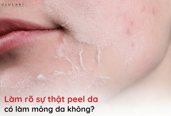 peel da có làm mỏng da không