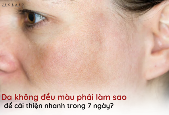 da không đều màu phải làm sao