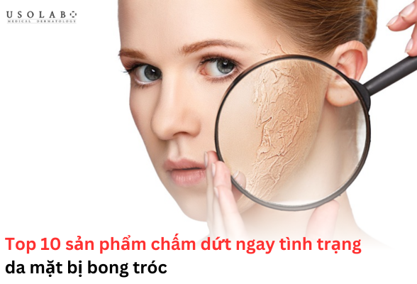 da mặt bị bong tróc