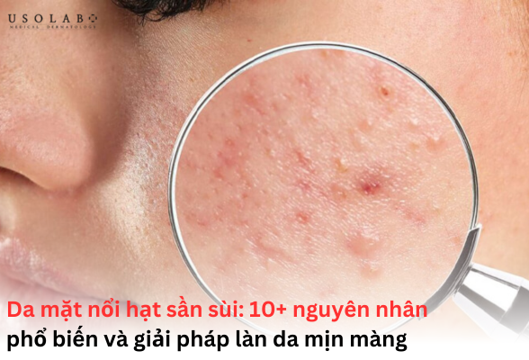 da mặt nổi hạt sần sùi