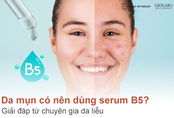 Da mụn có nên dùng serum B5? Giải đáp từ chuyên gia da liễu