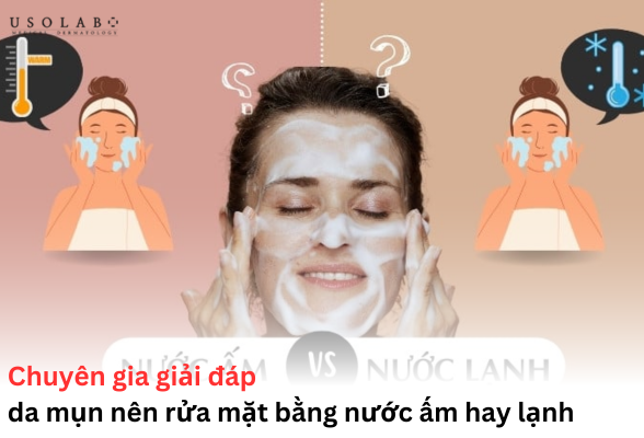 da mụn nên rửa mặt bằng nước ấm hay lạnh