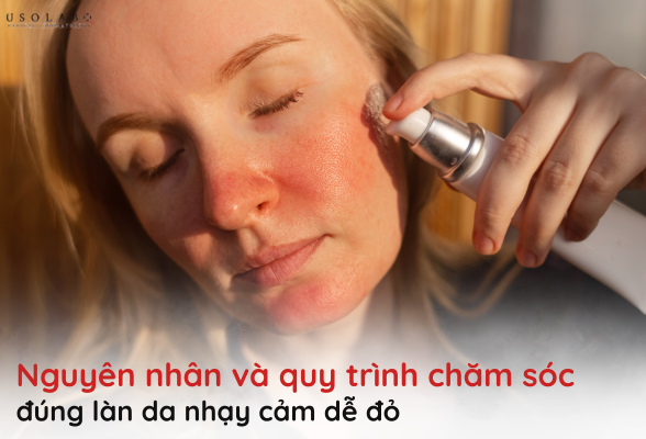 da nhạy cảm dễ đỏ