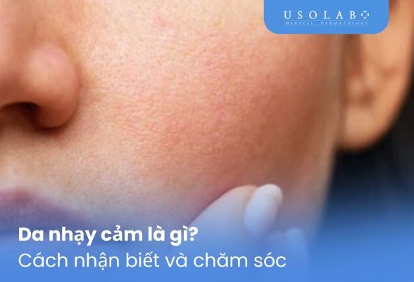 Da nhạy cảm là gì