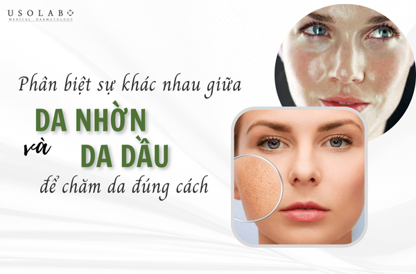 Da nhờn và da dầu khác gì nhau? Phân biệt để chăm sóc đúng cách