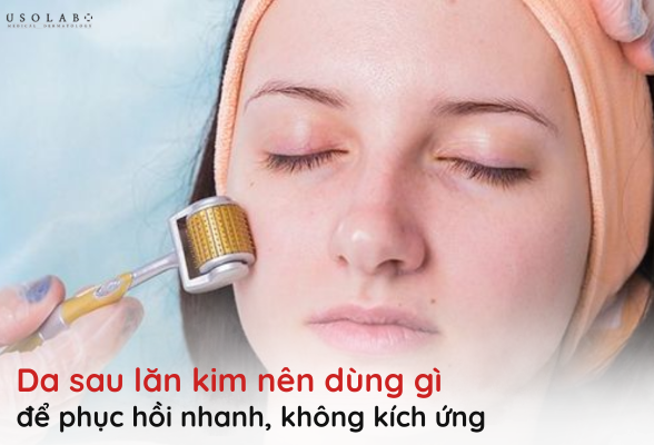 da sau lăn kim nên dùng gì