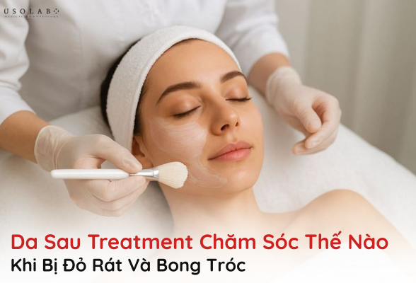 da sau treatment chăm sóc thế nào