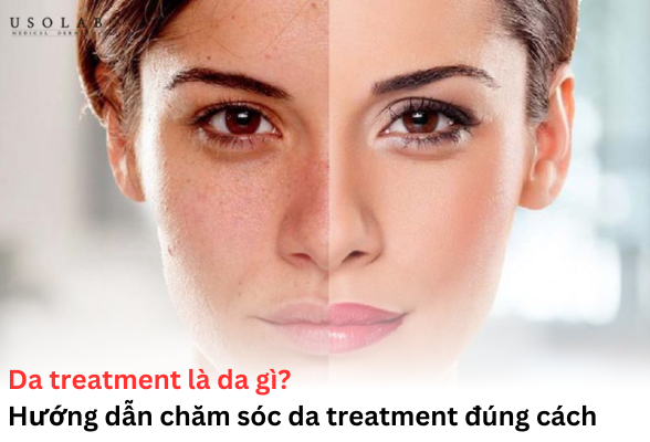 da treatment là da gì