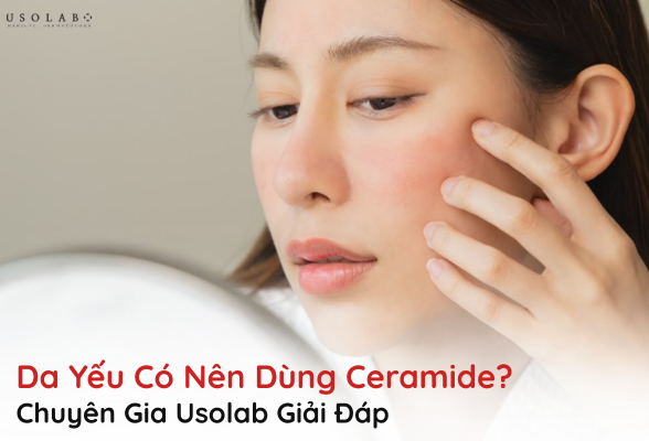 da yếu có nên dùng ceramide