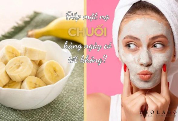 đắp mặt nạ chuối hàng ngày có tốt không