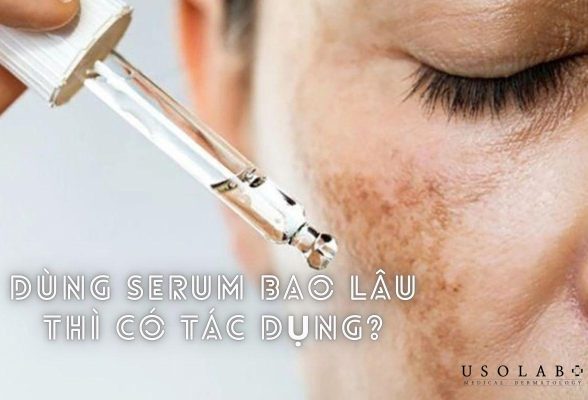 Dùng serum bao lâu thì có tác dụng