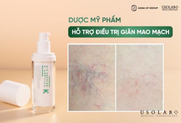 Top 10 dược mỹ phẩm hỗ trợ điều trị giãn mao mạch tốt nhất 