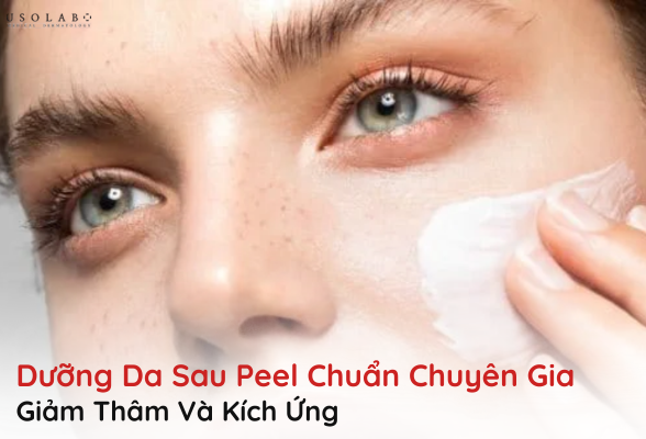 dưỡng da sau peel