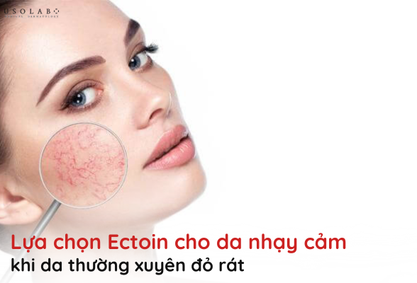 ectoin cho da nhạy cảm