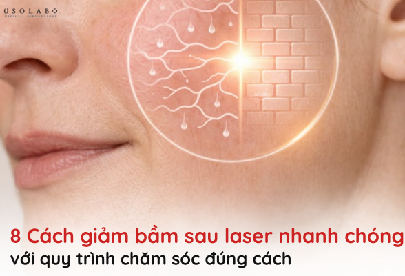 giảm bầm sau laser