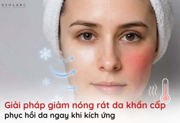 giảm nóng rát da