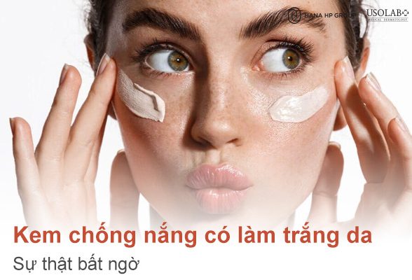 Kem chống nắng có làm trắng da không? Sự thật bất ngờ