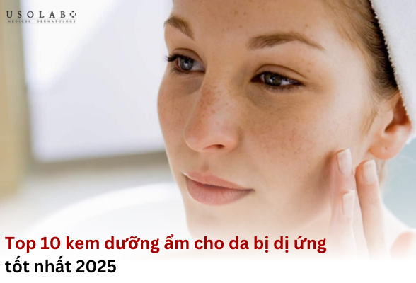 kem dưỡng ẩm cho da bị dị ứng