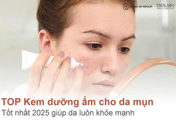 Top 7 kem dưỡng ẩm cho da mụn tốt nhất 2025 giúp da luôn khỏe mạnh