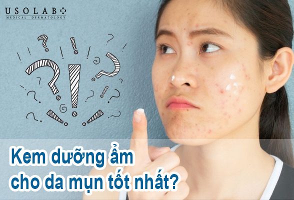 kem-duong-am-cho-da-mun