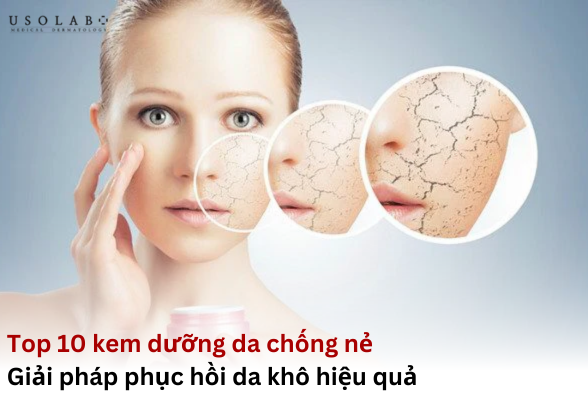 kem dưỡng da chống nẻ