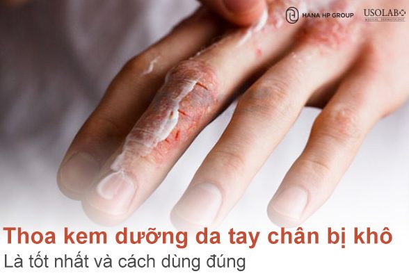 Thoa kem dưỡng da tay chân bị khô vào lúc nào là tốt nhất? Cách dùng đúng