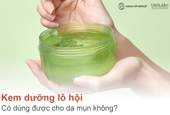 Kem dưỡng lô hội có dùng được cho da mụn không? Tốt cho da không?