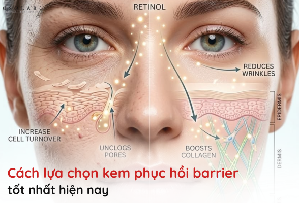 kem phục hồi barrier tốt nhất