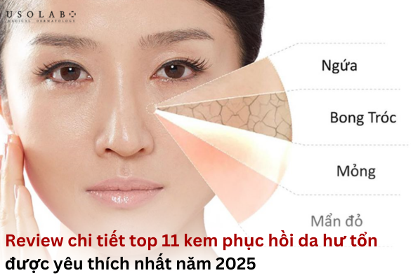 kem-phuc-hoi-cho-da-hu-ton kem phục hồi da hư tổn