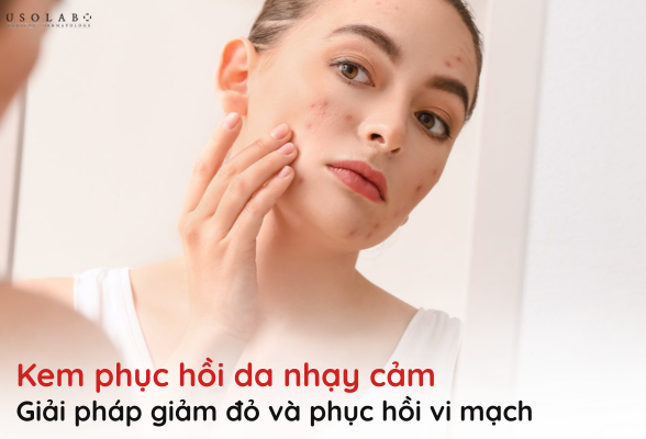 kem phục hồi da nhạy cảm