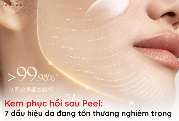 kem phục hồi sau peel