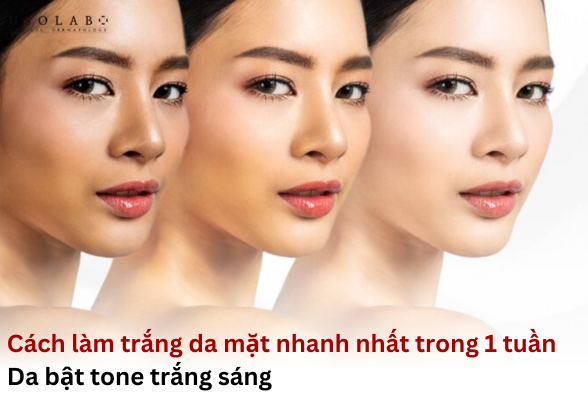 lam-trang-da-trong-1-tuan cách làm trắng da mặt nhanh nhất trong 1 tuần