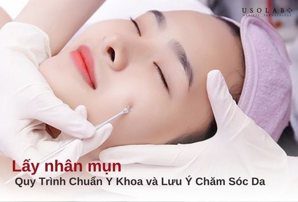 lấy nhân mụn