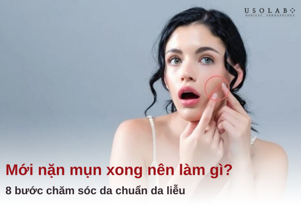mới nặn mụn xong nên làm gì
